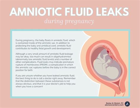 how do you know your leaking amniotic fluid|Leaking Amniotic Fluid: Signs, Causes, and。